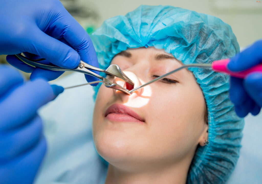 Functional Endoscopic Sinus Surgery 1 scaled