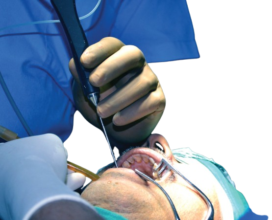 best salivary gland surgeon in kolkata removebg preview