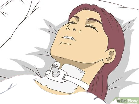 v4 460px Perform Tracheostomy Care Step 4 Version 4 removebg preview