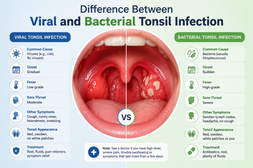 Difference Between Viral and Bacterial Tonsil Infection